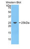 Coagulation Factor IX antibody, LS-C294075, Lifespan Biosciences, Western Blot image 
