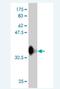 E3 ubiquitin-protein ligase RFWD3 antibody, H00055159-M01, Novus Biologicals, Western Blot image 