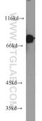 Rho GTPase Activating Protein 25 antibody, 14349-1-AP, Proteintech Group, Western Blot image 