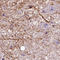 Adrenoceptor Beta 3 antibody, HPA061969, Atlas Antibodies, Immunohistochemistry paraffin image 