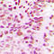 DNA Methyltransferase 3 Beta antibody, LS-C352124, Lifespan Biosciences, Immunohistochemistry frozen image 