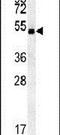 Protein shisa-7 antibody, PA5-25713, Invitrogen Antibodies, Western Blot image 