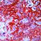 Keratin 14 antibody, MA5-11599, Invitrogen Antibodies, Immunohistochemistry frozen image 