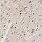 Family With Sequence Similarity 160 Member B2 antibody, 18-988, ProSci, Immunohistochemistry paraffin image 