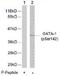 GATA Binding Protein 1 antibody, TA309953, Origene, Western Blot image 