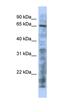 Lysine Acetyltransferase 5 antibody, orb324420, Biorbyt, Western Blot image 