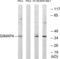 GTPase, IMAP Family Member 4 antibody, LS-C120022, Lifespan Biosciences, Western Blot image 