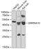 Serpin Family A Member 10 antibody, GTX55791, GeneTex, Western Blot image 