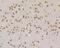 MutS Homolog 2 antibody, NBP2-76898, Novus Biologicals, Immunohistochemistry paraffin image 