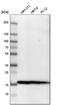 NME/NM23 Nucleoside Diphosphate Kinase 1 antibody, HPA008467, Atlas Antibodies, Western Blot image 