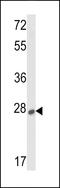 Sclerostin antibody, 62-203, ProSci, Western Blot image 