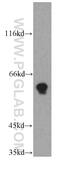 Transmembrane Phosphatase With Tensin Homology antibody, 12982-1-AP, Proteintech Group, Western Blot image 