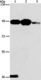 Phospholipase A2 Group IVB antibody, PA5-50642, Invitrogen Antibodies, Western Blot image 