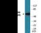 Ribosomal Protein S6 Kinase B1 antibody, EKC2096, Boster Biological Technology, Western Blot image 