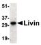 Baculoviral IAP Repeat Containing 7 antibody, PA5-19990, Invitrogen Antibodies, Western Blot image 