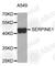 Serpin Family E Member 1 antibody, A6211, ABclonal Technology, Western Blot image 