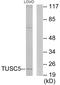 Trafficking Regulator Of GLUT4 (SLC2A4) 1 antibody, GTX87917, GeneTex, Western Blot image 