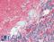 Neural Cell Adhesion Molecule 1 antibody, LS-B15335, Lifespan Biosciences, Immunohistochemistry paraffin image 
