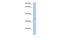 NSF Attachment Protein Beta antibody, A00939, Boster Biological Technology, Western Blot image 