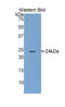 Glutamate Receptor Interacting Protein 1 antibody, LS-C304380, Lifespan Biosciences, Western Blot image 