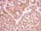 RNA Polymerase II Subunit B antibody, NBP2-53092, Novus Biologicals, Immunohistochemistry paraffin image 