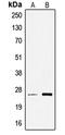 Transcription Elongation Factor A Like 6 antibody, LS-C353650, Lifespan Biosciences, Western Blot image 