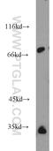 Glycerophosphodiester Phosphodiesterase Domain Containing 5 antibody, 16494-1-AP, Proteintech Group, Western Blot image 