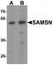 SAM Domain, SH3 Domain And Nuclear Localization Signals 1 antibody, TA319998, Origene, Western Blot image 