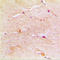 Actin Gamma 1 antibody, LS-C351786, Lifespan Biosciences, Immunohistochemistry paraffin image 