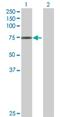 G Protein Nucleolar 1 (Putative) antibody, H00002794-B01P, Novus Biologicals, Western Blot image 