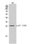 Cyclin Dependent Kinase Inhibitor 1B antibody, STJ90519, St John