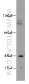 Gamma-Butyrobetaine Hydroxylase 1 antibody, 16099-1-AP, Proteintech Group, Western Blot image 