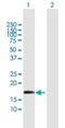 Zinc Finger Protein 280D antibody, H00054816-B01P, Novus Biologicals, Western Blot image 