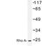 Ras Homolog Family Member A antibody, LS-C176626, Lifespan Biosciences, Western Blot image 