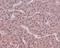 Caspase 9 antibody, M00080-3, Boster Biological Technology, Immunohistochemistry paraffin image 