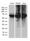 Protein Phosphatase, Mg2+/Mn2+ Dependent 1D antibody, LS-C795826, Lifespan Biosciences, Western Blot image 
