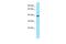 G Protein Subunit Alpha 11 antibody, PA5-70665, Invitrogen Antibodies, Western Blot image 