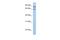 Protein Phosphatase 1 Regulatory Subunit 10 antibody, A06567-1, Boster Biological Technology, Western Blot image 