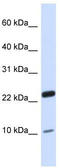 TATA-Box Binding Protein Associated Factor 13 antibody, TA342436, Origene, Western Blot image 