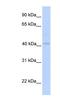 Gasdermin B antibody, NBP1-54598, Novus Biologicals, Western Blot image 