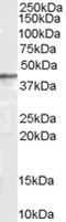 Arrestin Beta 2 antibody, EB06745, Everest Biotech, Western Blot image 