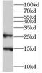 Transmembrane Protein 182 antibody, FNab08764, FineTest, Western Blot image 