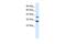 TAL BHLH Transcription Factor 1, Erythroid Differentiation Factor antibody, PA5-46869, Invitrogen Antibodies, Western Blot image 