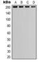 TSC Complex Subunit 2 antibody, orb338884, Biorbyt, Western Blot image 