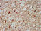 Branched Chain Keto Acid Dehydrogenase E1 Subunit Alpha antibody, CSB-PA002605LA01HU, Cusabio, Immunohistochemistry frozen image 