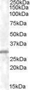 Charged Multivesicular Body Protein 5 antibody, LS-C54653, Lifespan Biosciences, Western Blot image 