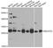 NADH:Ubiquinone Oxidoreductase Core Subunit S3 antibody, A8013, ABclonal Technology, Western Blot image 