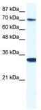 CCR4-NOT Transcription Complex Subunit 3 antibody, TA335619, Origene, Western Blot image 