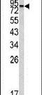 Carboxypeptidase X, M14 Family Member 2 antibody, PA5-13500, Invitrogen Antibodies, Western Blot image 