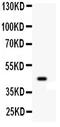 Wnt Family Member 2B antibody, PB9462, Boster Biological Technology, Western Blot image 